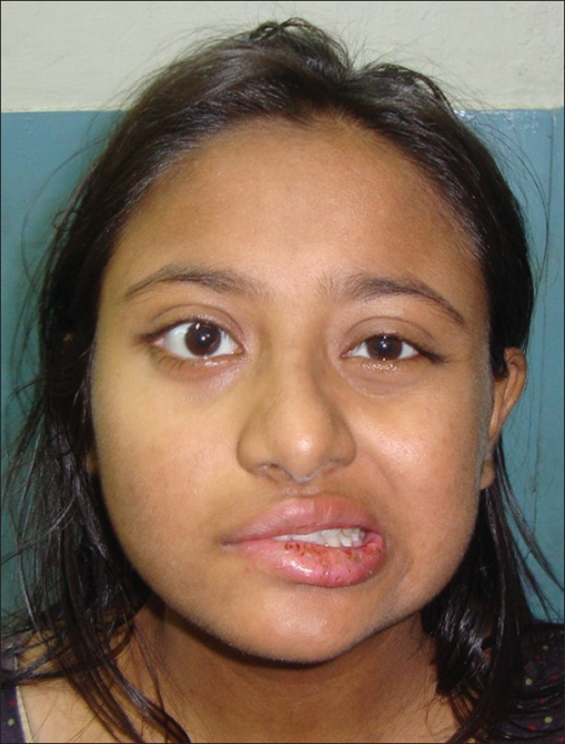 Nice clean softcore nudes Right facial palsy
